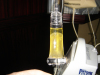 Tori's Umbilical Stem Cells and Nerve Growth Factor Tori's Umbilical Stem Cells and Nerve Growth Factor
