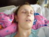 Tori's face acupuncture Tori's face acupuncture